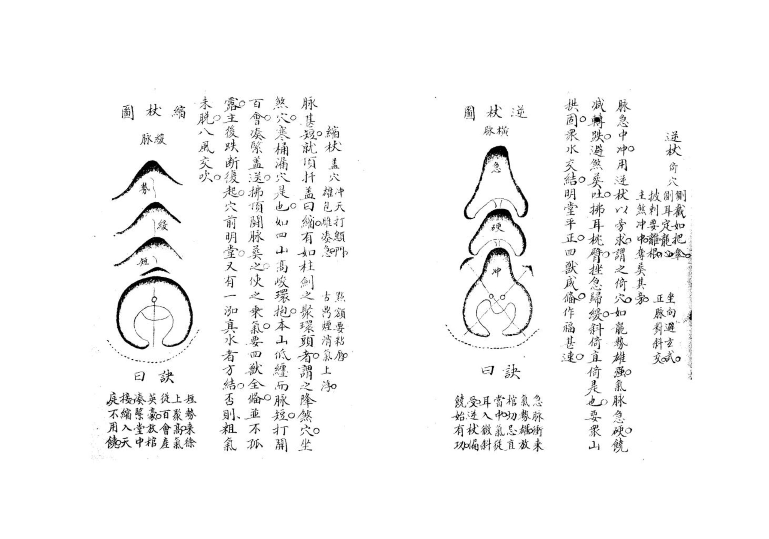 倒杖十二法(倒杖十二法口诀原文)